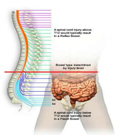 neurogenic bowel management