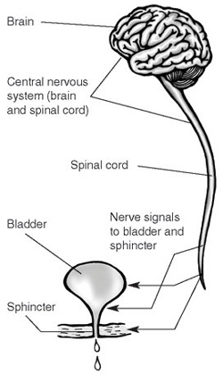 Neurogenic bladder management following spinal injury